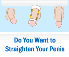 curved penis solution